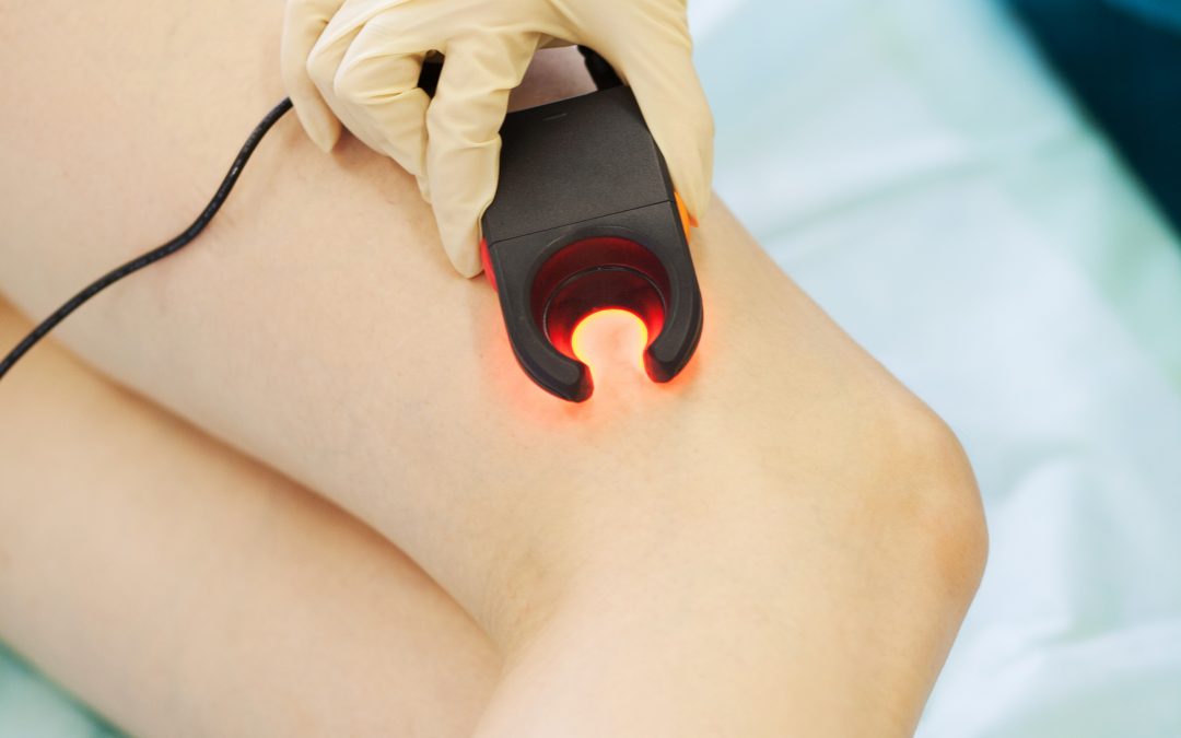 We Use A Vein Light To Help Identify The Best Area To Treat Spider